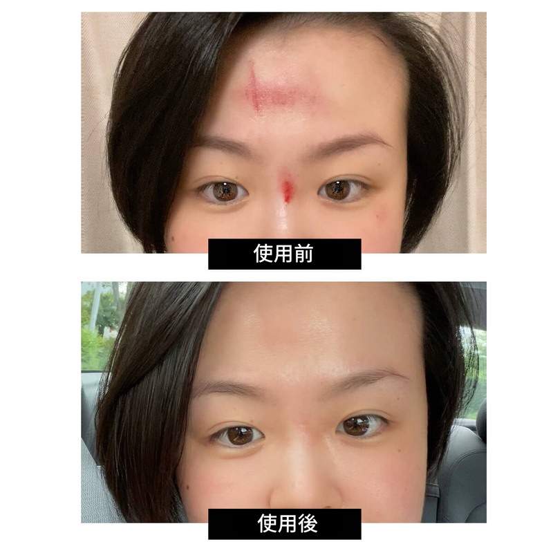 CurrentBody skin LEDライトセラピーマスク