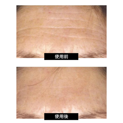 CurrentBody skin LEDライトセラピーマスク 特別価格