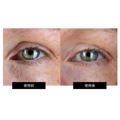 CurrentBody Skin RF ラジオ波 美顔器 特別価格