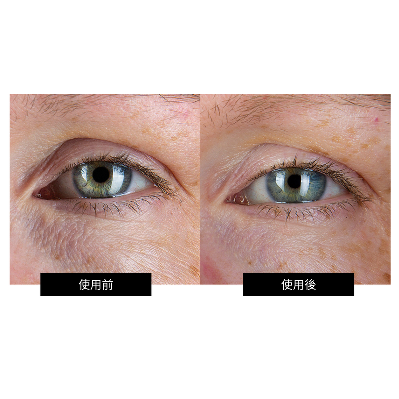 CurrentBody Skin RF ラジオ波 美顔器 特別価格